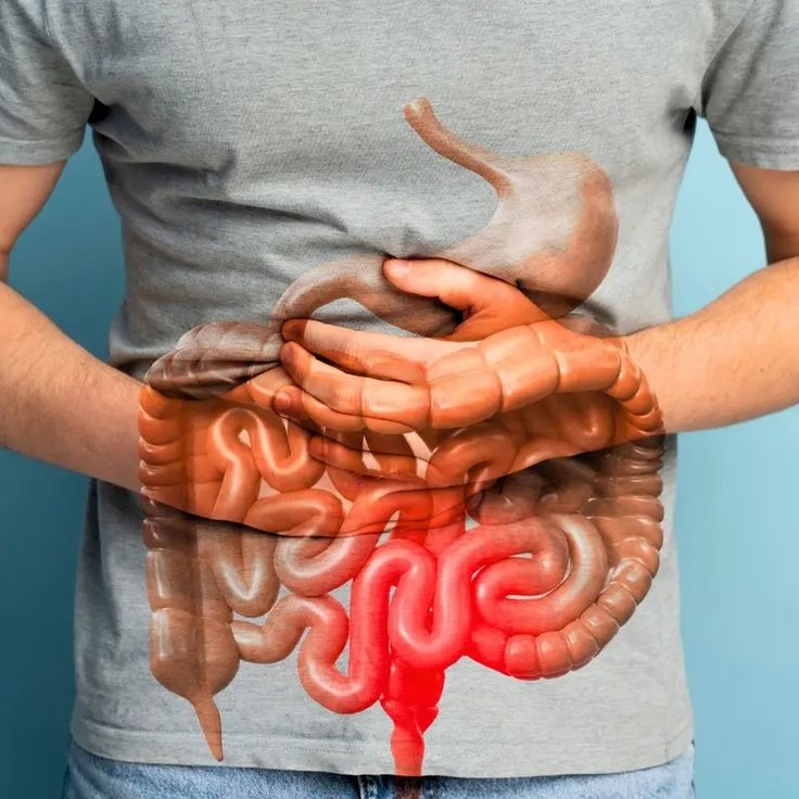 NEXTY NEST™ - GUT SUPPORT CAPSULE