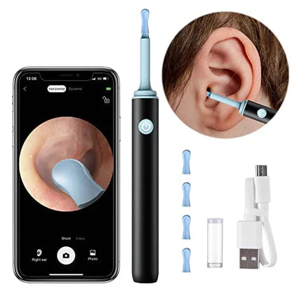 NEXTY NEST™   - PROFESSIONAL EAR WAX REMOVAL TOOL